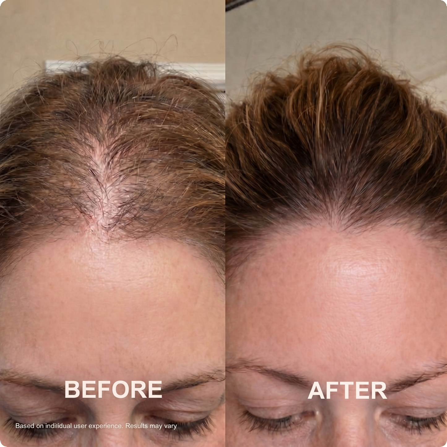 Heyra Hair Growth Gummies